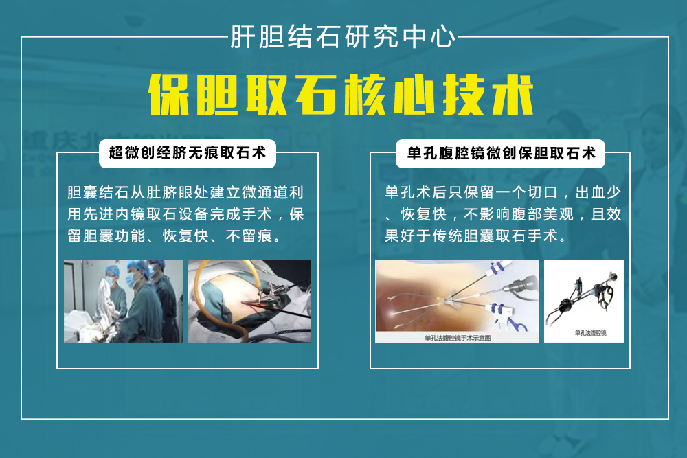 胆结石手术后需要注意哪些事项?