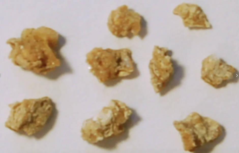 肾结石一定不能碰的三类饮料!